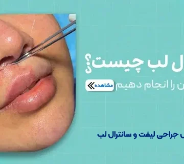سانترال لب چیست؟ و چرا باید آن را انجام دهیم؟