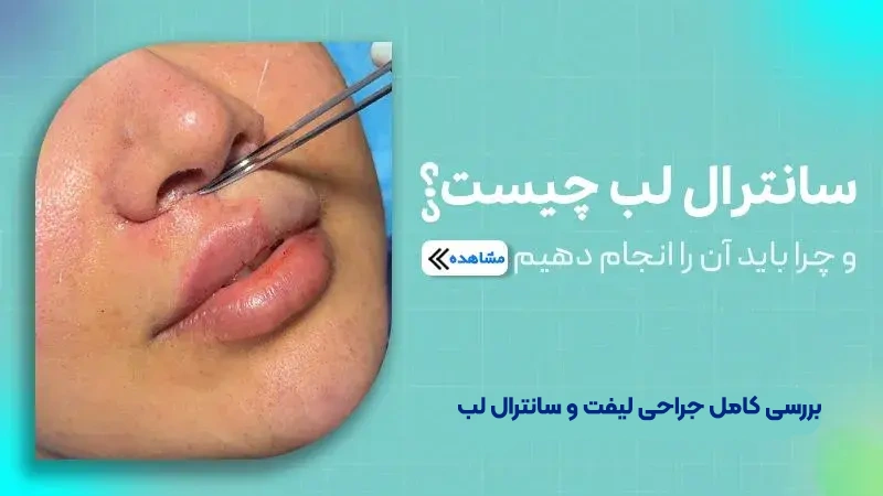 سانترال لب چیست؟ و چرا باید آن را انجام دهیم؟
