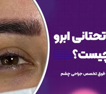 لیفت تحتانی ابرو برای چیست؟