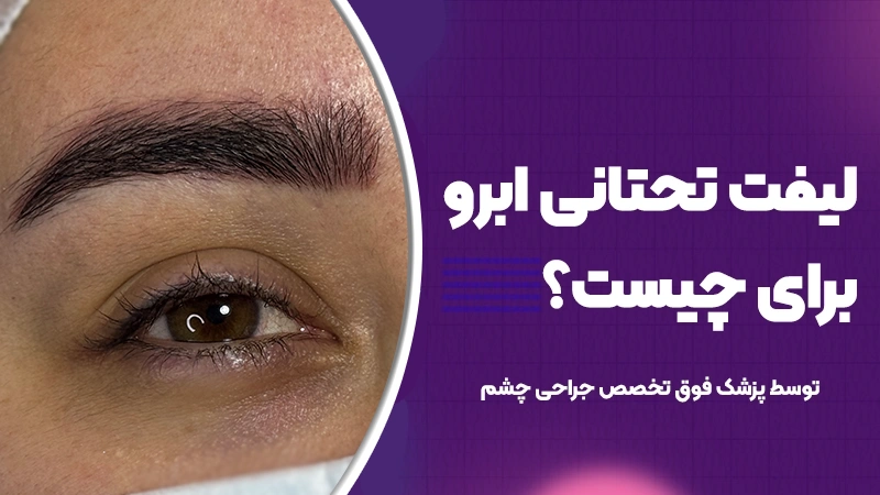 لیفت تحتانی ابرو برای چیست؟