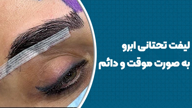 لیفت تحتانی ابرو به صورت موقت و دائم