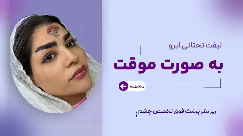 لیفت تحتانی ابرو به صورت موقت
