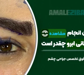 مدت زمان انجام لیفت تحتانی ابرو چقدر است؟