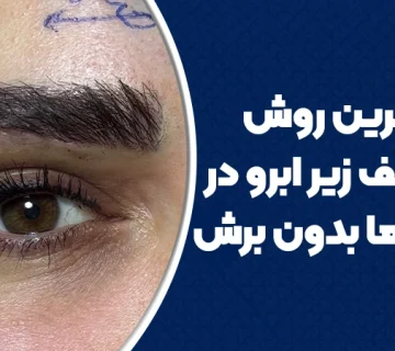 مدرن‌ترین روش حذف پف زیر ابرو در خانم‌‌ها بدون برش