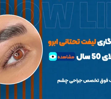 میزان ماندگاری لیفت تحتانی ابرو در افراد بالای ۵۰ سال