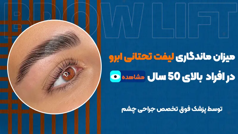 میزان ماندگاری لیفت تحتانی ابرو در افراد بالای ۵۰ سال