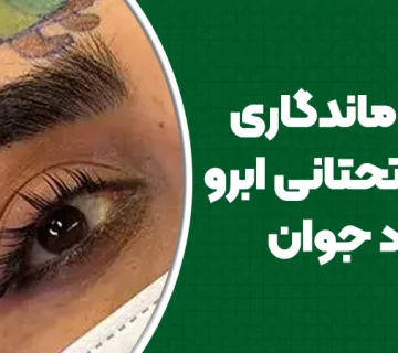 میزان ماندگاری لیفت تحتانی ابرو در افراد جوان