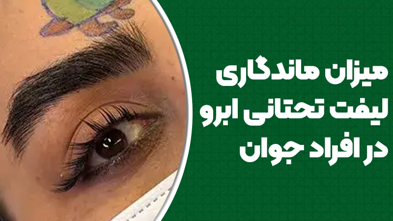میزان ماندگاری لیفت تحتانی ابرو در افراد جوان